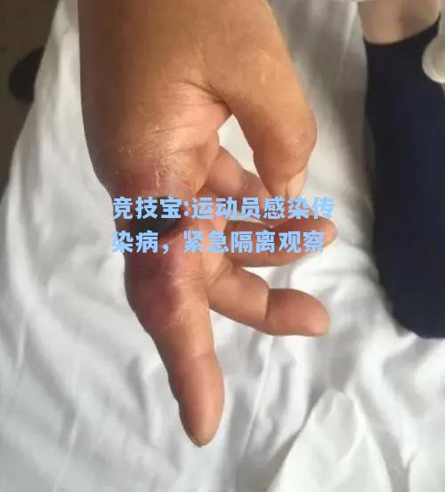 运动员感染传染病，紧急隔离观察